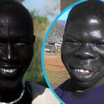 the Blackest Person in the World